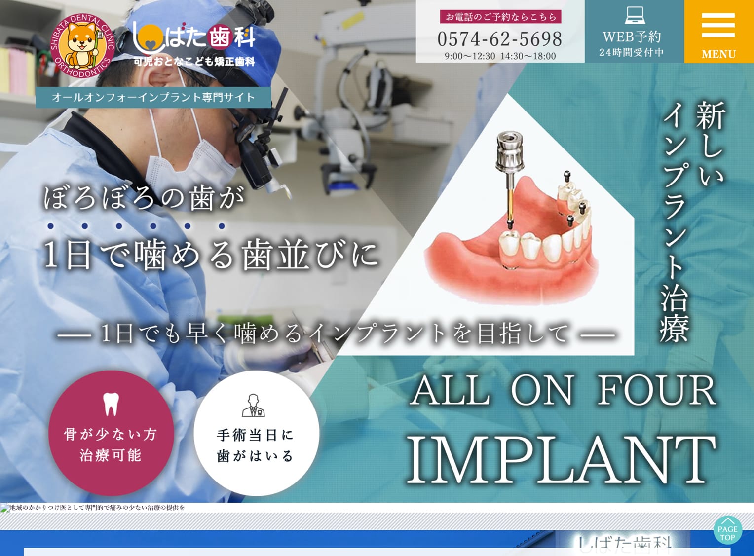 医療法人AKATSUKI しばた歯科可児おとなこども矯正歯科様 オールオンフォー専門サイト